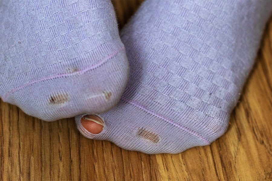 Symbolbild: Lauffaul, Löcher in Socken oder Schuhen, Zehenspitzengang